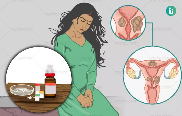 Homeopathic solutions for Hormone Disorders